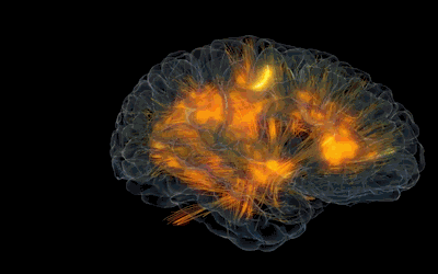 brainz.gif